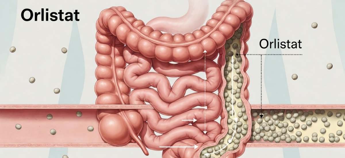 Orlistat zur Gewichtskontrolle: Was Sie vor der Anwendung wissen sollten